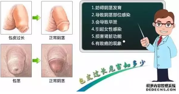 阿拉尔男性专题!哪里做包皮好