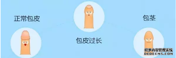 昌吉库车县割包皮有啥好处