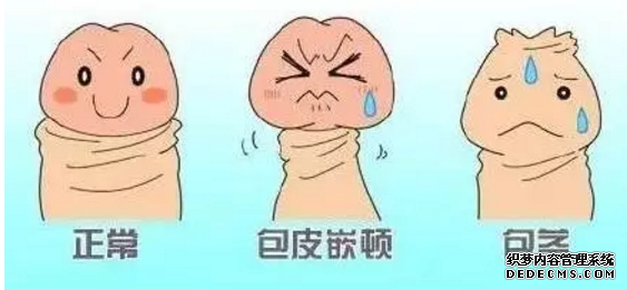 阿拉尔男科哪里的包皮手术做得好