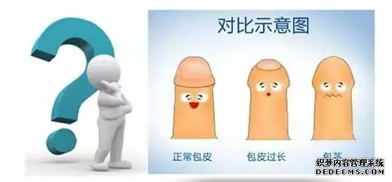 阿拉尔市男人包皮过长为什么要割?